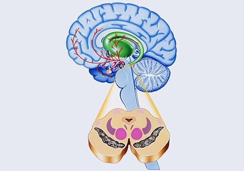 ps211130parkinsonsdiseasebrain500x350.jpg