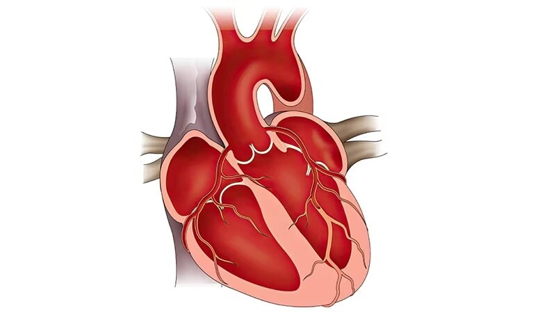 Fast Five Quiz: ATTR-CM Presentation and Diagnosis