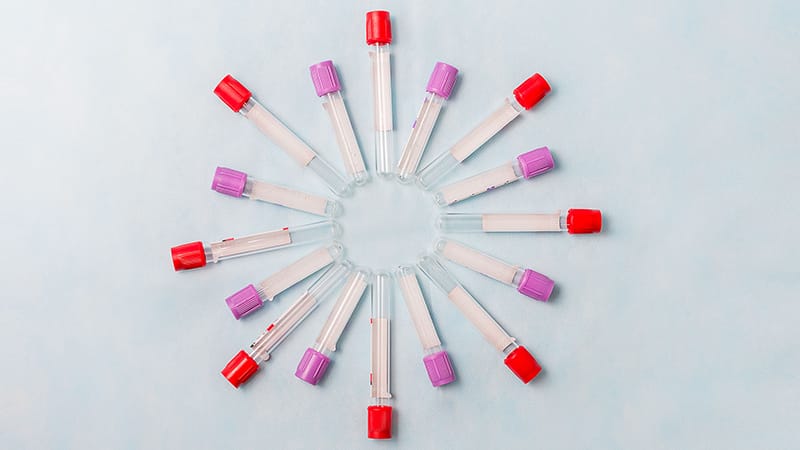 Vers un dépistage sanguin du cancer du pancréas