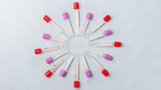 photo of Test tubes for laboratory diagnosis, for blood tests.