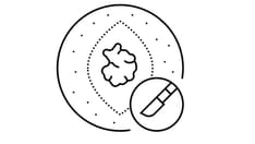 photo of Excision surgery doctor line icon illustration. Excision surgery doctor line icon vector. Excision surgery doctor si