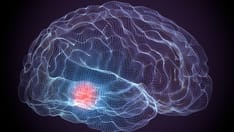 photo of Parkinson degenerative brain diseases on a dark background
