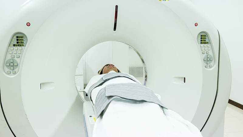 Scanner Capes Femmes en âge de procréer : prescrire le scanner à bon escient