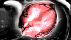 photo of heart MRI