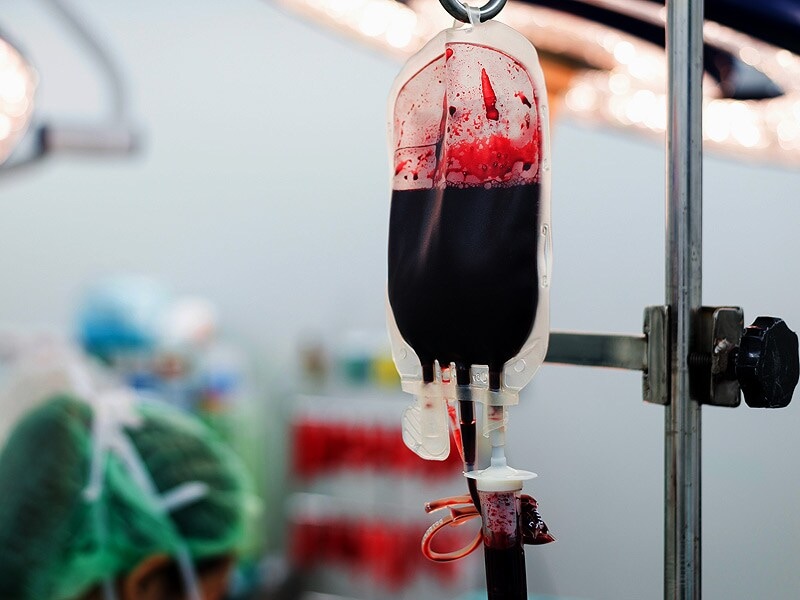 Delays a Major Cause of Transfusion-related Deaths