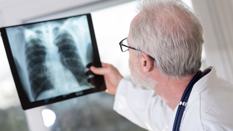 Routine Checks for Cancer Metastases: A Help or Harm?