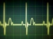 EKG