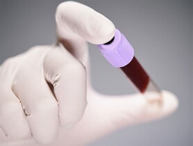 photo of a blood test