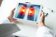 photo of doctor holding lungs scan