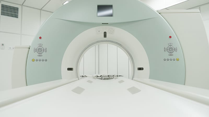 Scanner Capes Scanner et risque de cancer : au-delà des chiffres choc