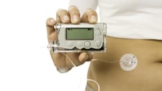 photo of insulin pump