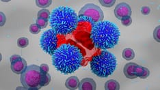photo of lymphoma