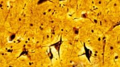 photo of neurons