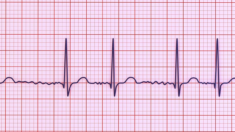 Aging Europe Faces AF Surge as Clinical Complexity Deepens