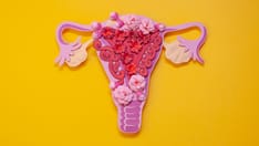 photo of uterus