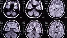 photo of brain xray