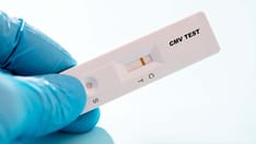 photo of cmv test