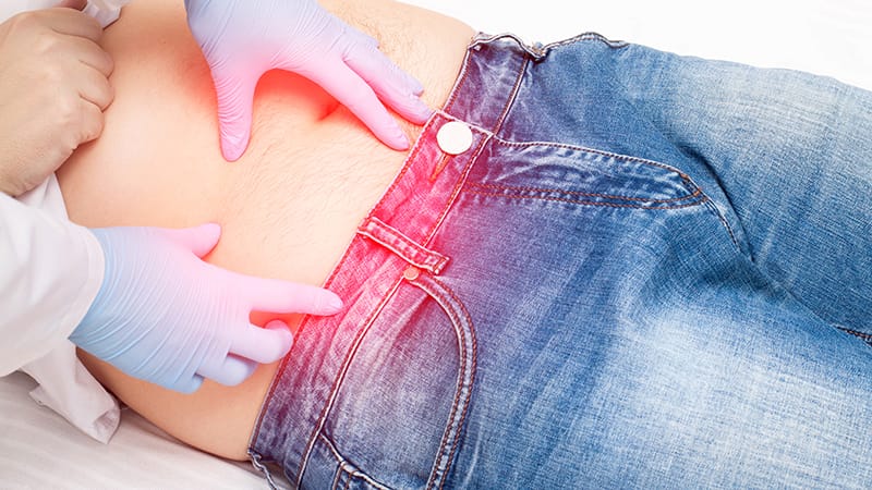 Antibióticos frente a cirugía: evidencia a 10 años en casos de apendicitis no complicada