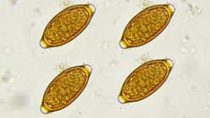 photo of trichuris