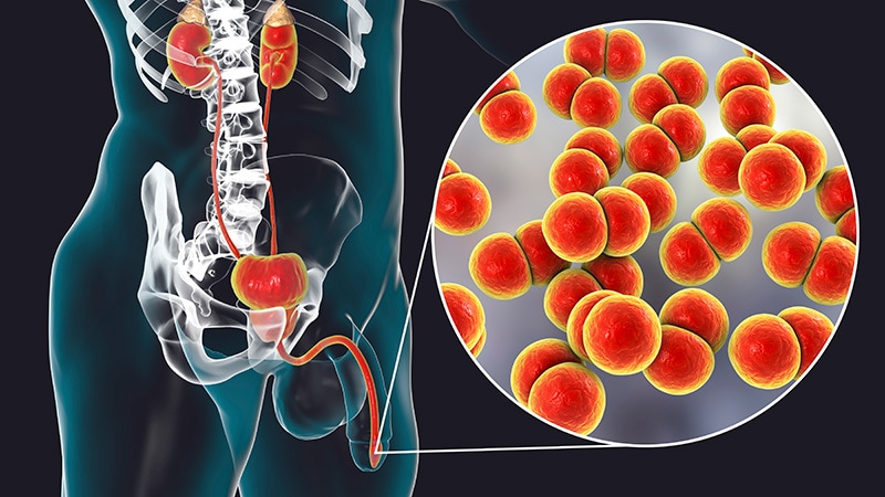 Doxycycline Postexposure Prophylaxis (Doxy-PEP): 5 Things to Know