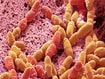 photo of Streptococcus mutans, SEM
