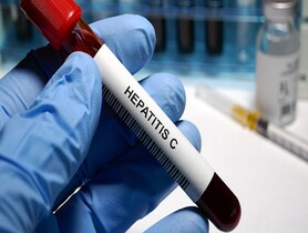 photo of Hepatitis C test tube