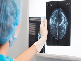 photo of a mammogram