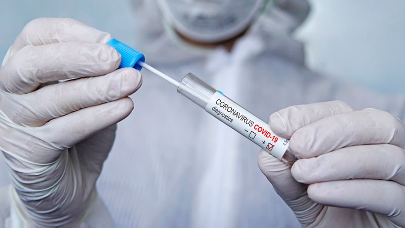 Un programme fédéral offre des tests gratuits de COVID, de grippe à domicile et de Rx