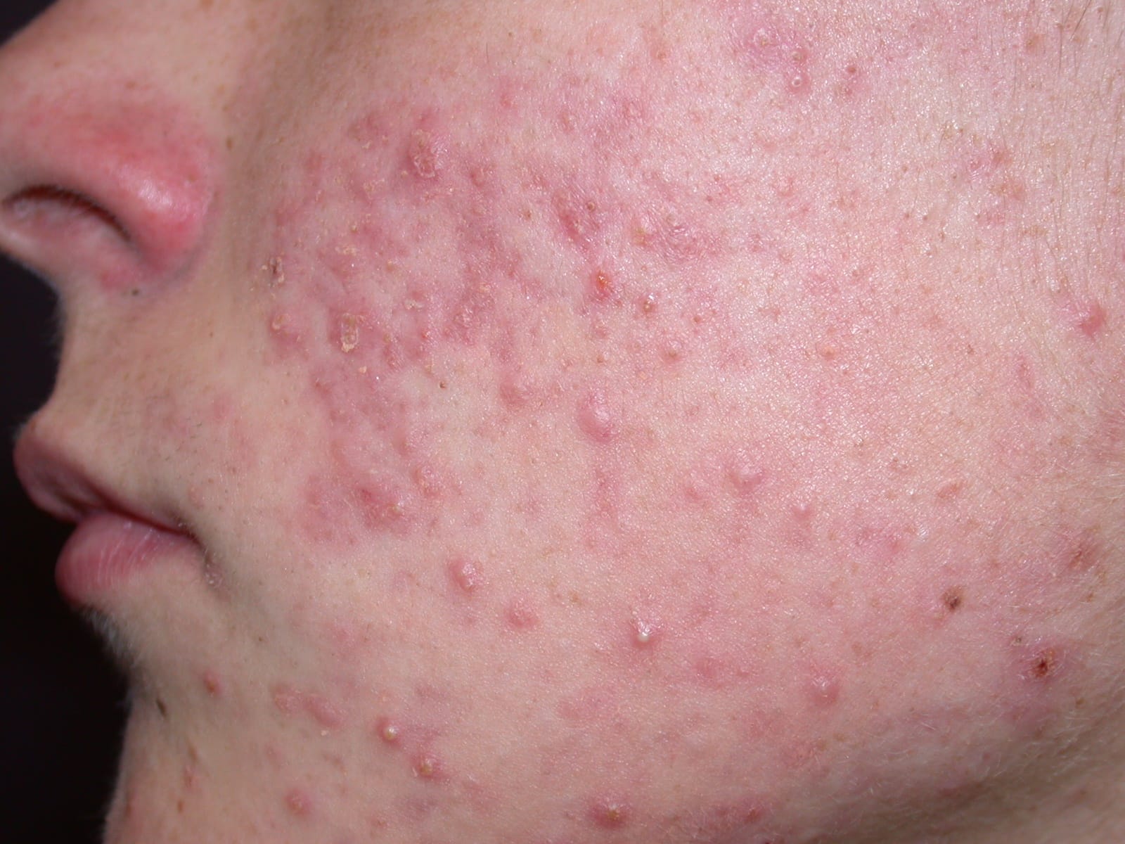 Facial Rashes: What's the Diagnosis?