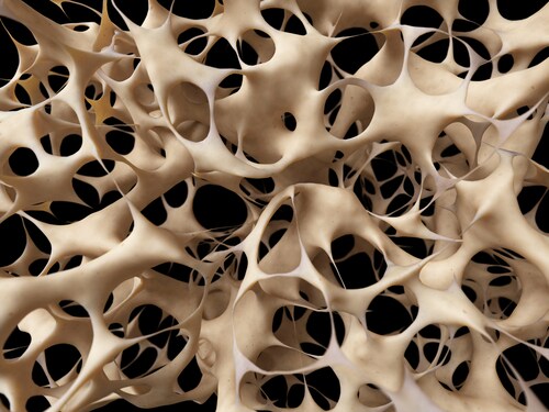 Potential Cardiovascular Risk Of Novel Osteoporosis Drug