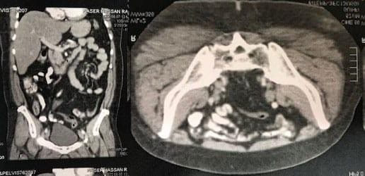 Desafio Diagnóstico: Médica de 29 anos com dor abdominal