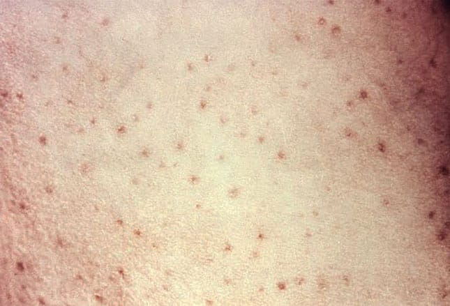 Sinais dermatológicos de deficiências nutricionais