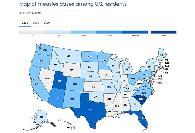Measles: More Than Just a Rash