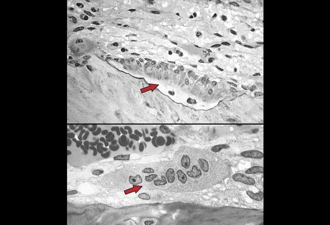 photo of Bone mineral density