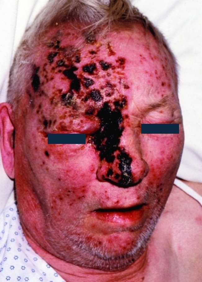 C682025-fig2.jpg
