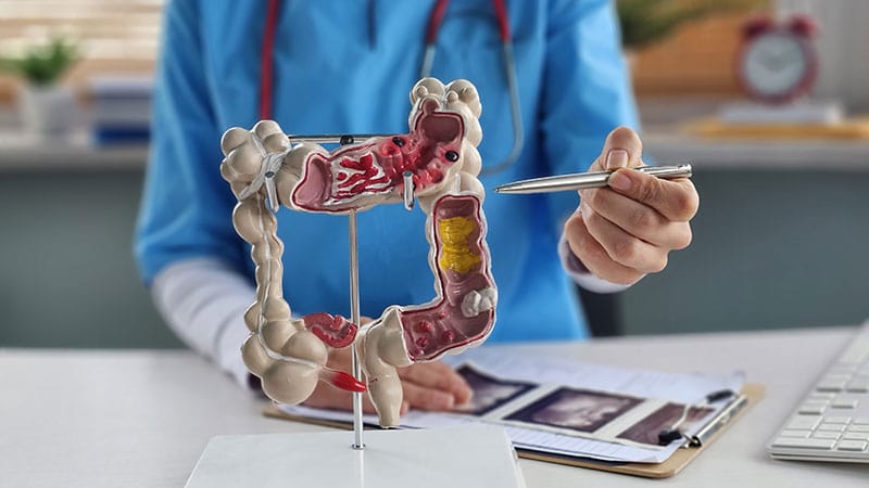 Education Gap Tied to Higher Risk for Young-Onset CRC Death