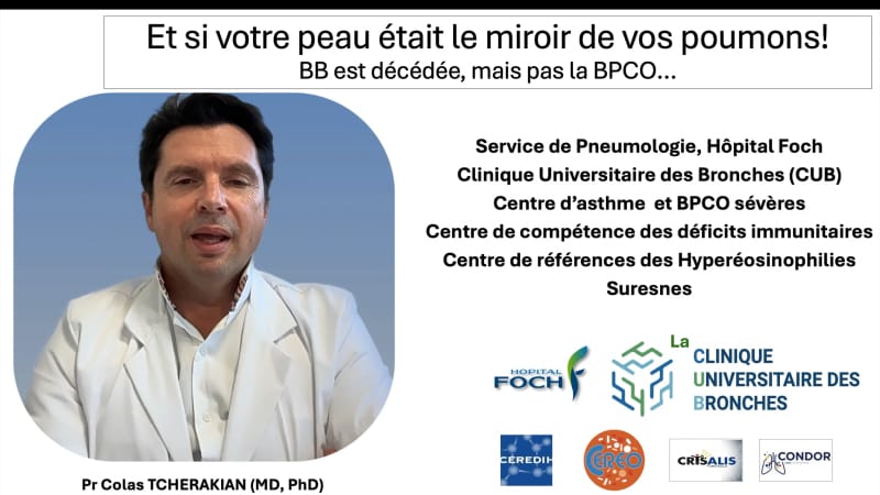 Vieillissement cutané et BPCO : quels liens ?