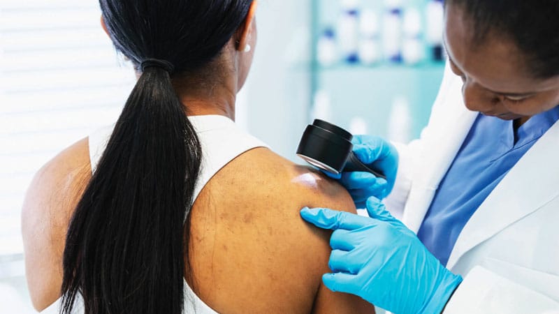 Cutaneous Toxicities of Cancer Therapy in Hispanic and Latino Adults