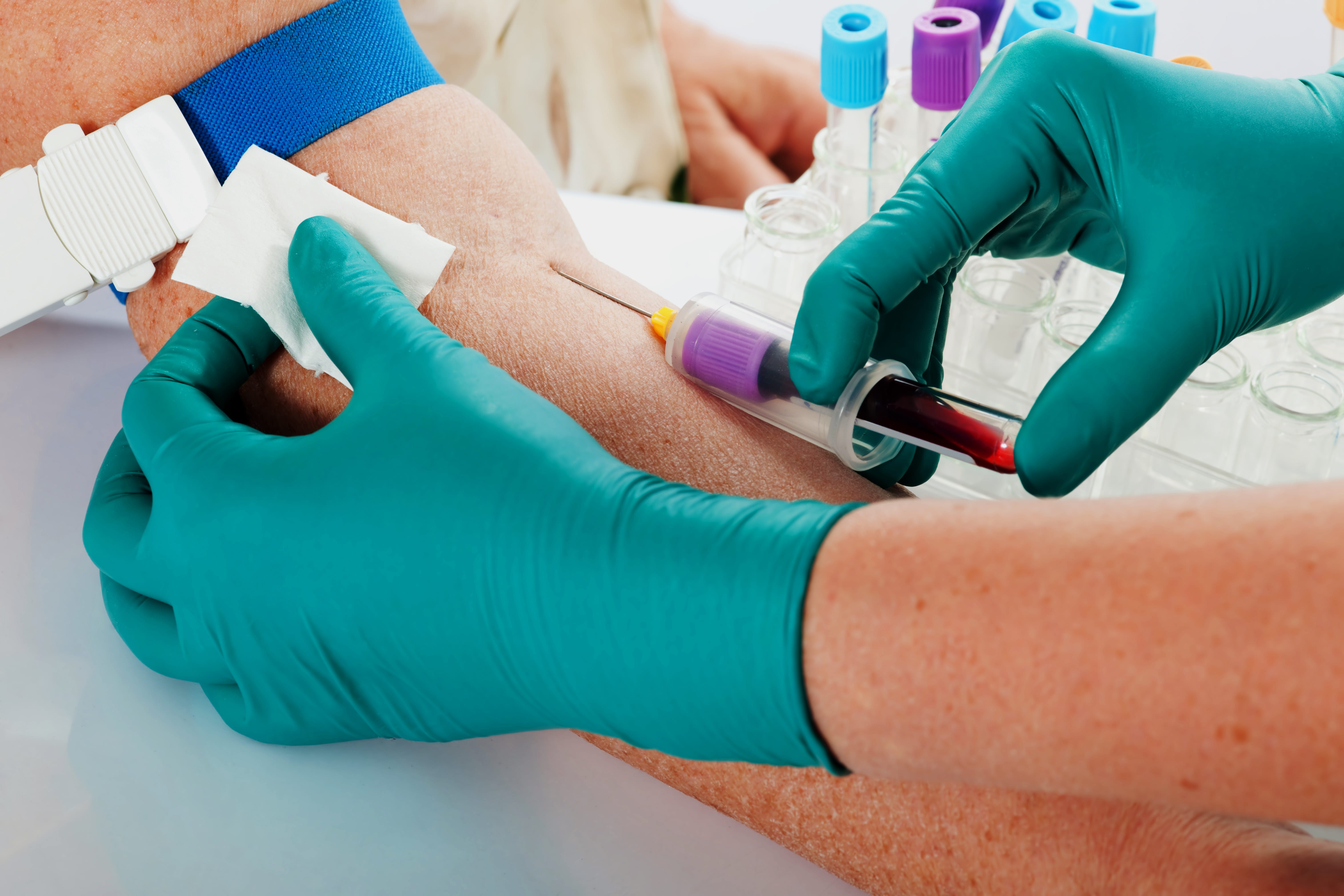 Breaking the Lab Habit: Rethinking Daily Hospital Testing