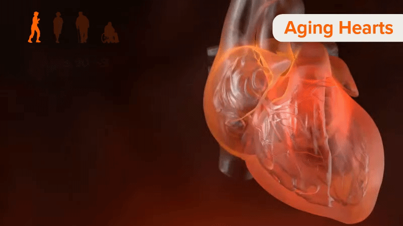 photo of an aging heart