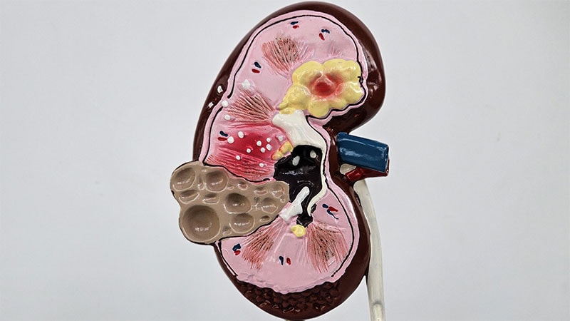 Hyperlactataemia Tied to Poor Mortality in Patients With AKI