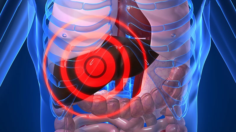 Semaglutide Therapy Improves Liver Histology in MASH