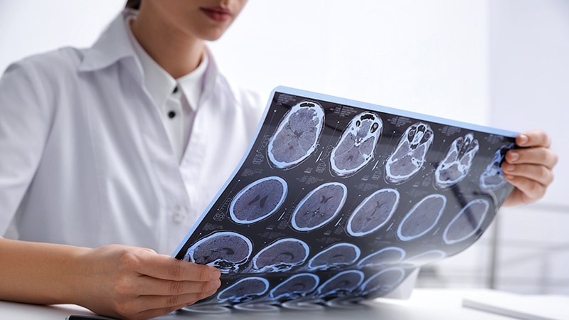 Experimental MS Drug Nearly Eliminates Disease Activity