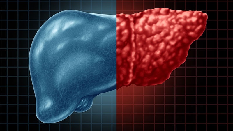 BMI & Nutrition Support Predict Weight Loss in Liver Disease
