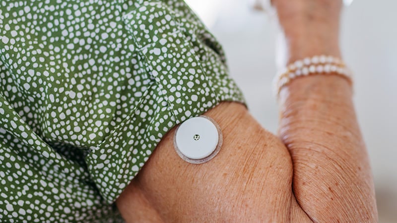 Brief Use of CGM May Enhance Lifestyle Awareness in T2D