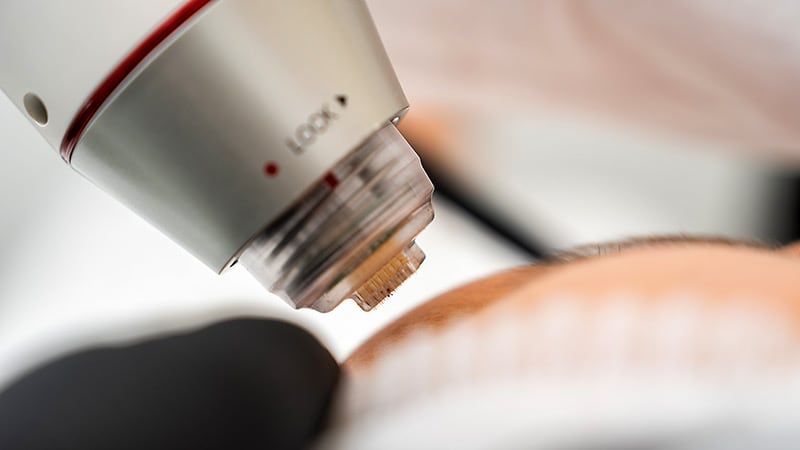 Children Need a Unique Approach for Dermatologic Laser Use