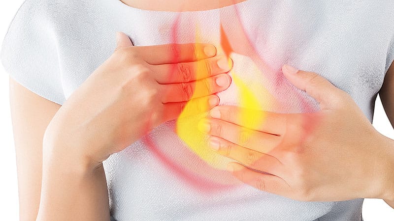 New GERD Score May Help Clinicians Spot Biggest Symptom