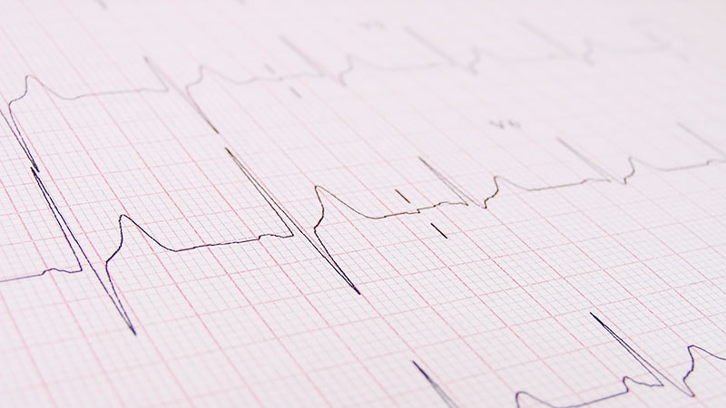 Cannabis Use Not Tied to ECG Changes in HIV+ Population