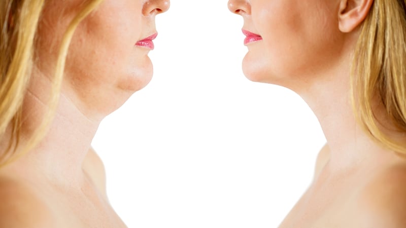 Estudo expõe bases racistas e falhas científicas do IMC