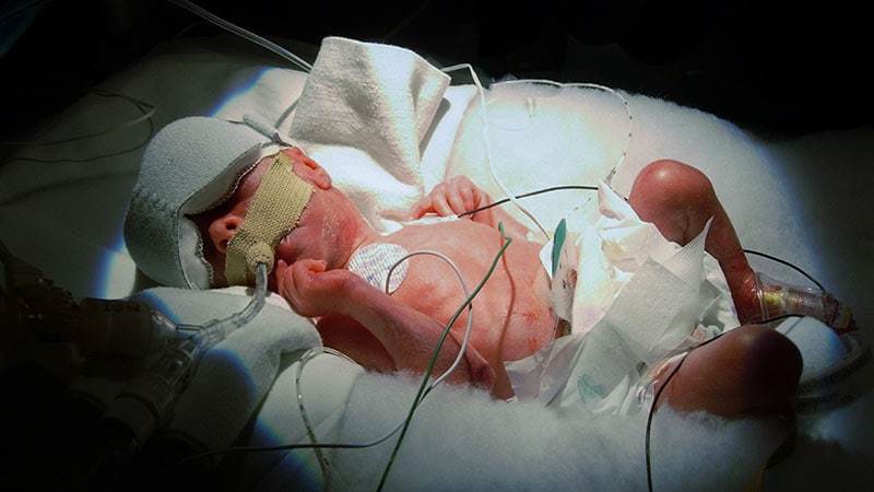 Preterm Babies May Safely Start Full Milk Feeds on Day 1